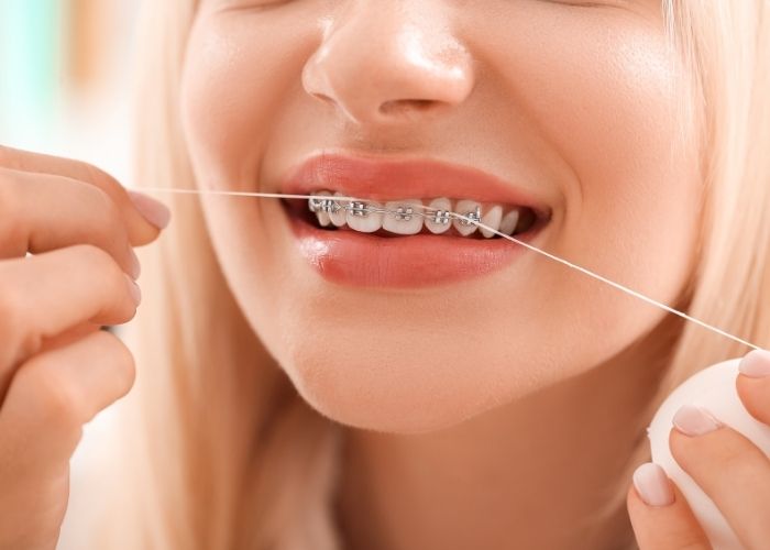 girl flossing metal braces