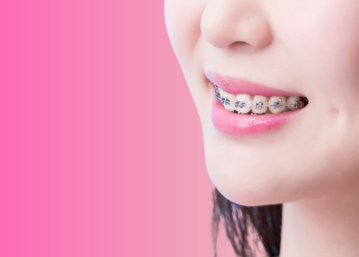girl smiling with metal braces on and a pink background
