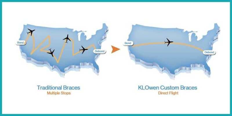 a picture that shows the difference between traditional braces and klowen custom braces.